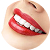 Blanqueamiento-Dental