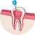 Endodoncia